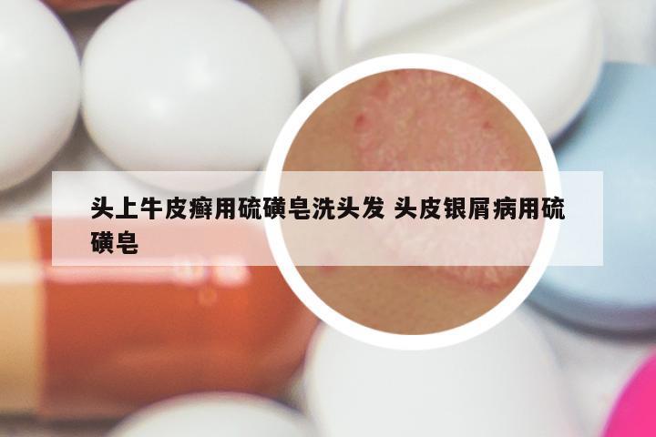 头上牛皮癣用硫磺皂洗头发 头皮银屑病用硫磺皂