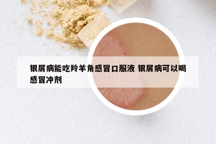 银屑病能吃羚羊角感冒口服液 银屑病可以喝感冒冲剂
