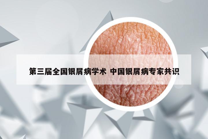 第三届全国银屑病学术 中国银屑病专家共识