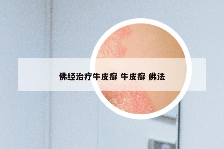佛经治疗牛皮癣 牛皮癣 佛法