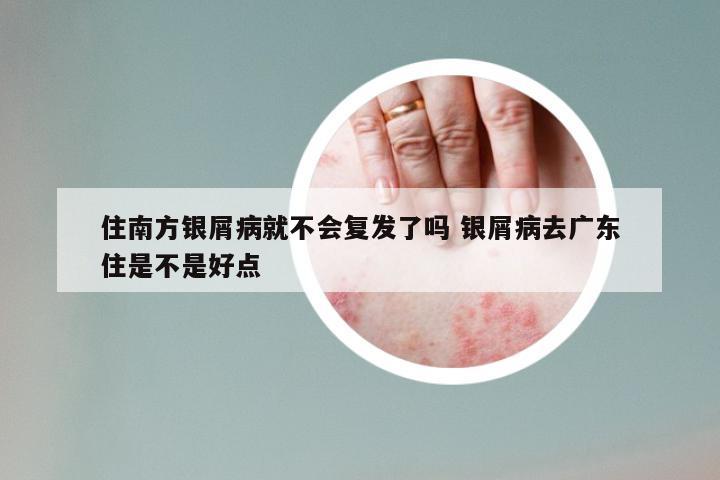 住南方银屑病就不会复发了吗 银屑病去广东住是不是好点