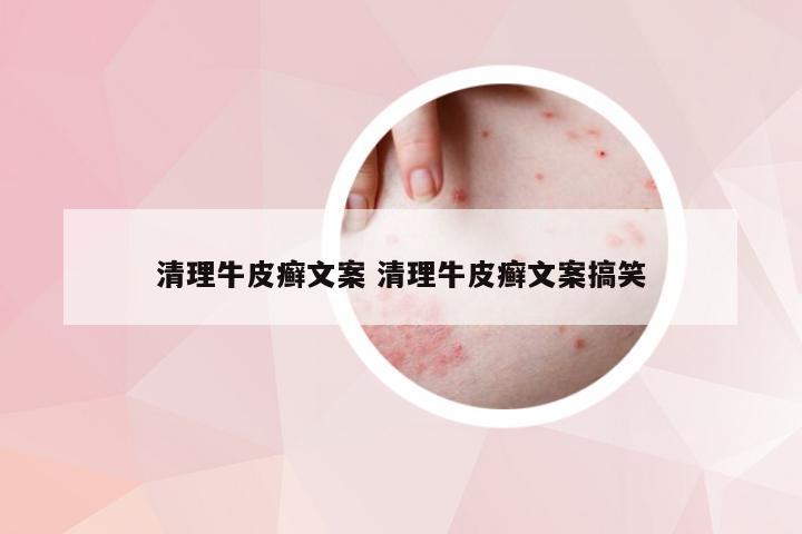 清理牛皮癣文案 清理牛皮癣文案搞笑