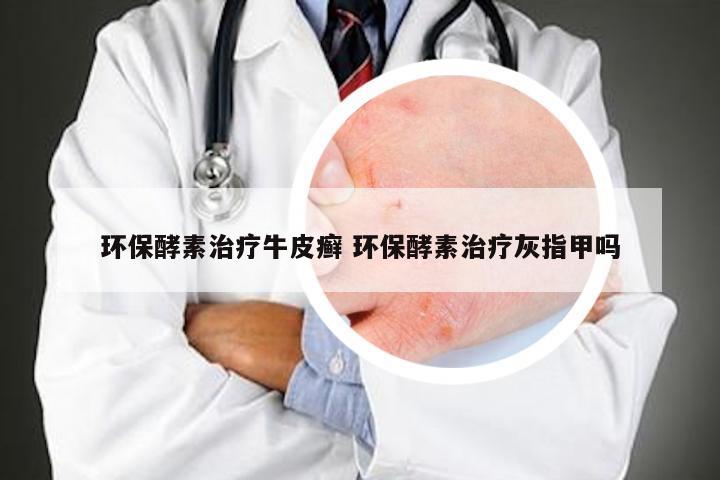 环保酵素治疗牛皮癣 环保酵素治疗灰指甲吗