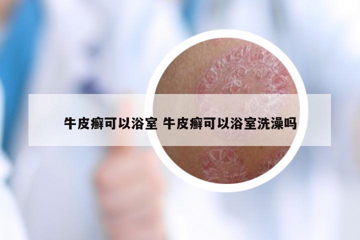 牛皮癣可以浴室 牛皮癣可以浴室洗澡吗