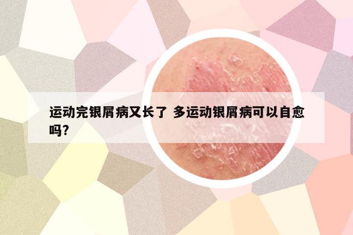 运动完银屑病又长了 多运动银屑病可以自愈吗?