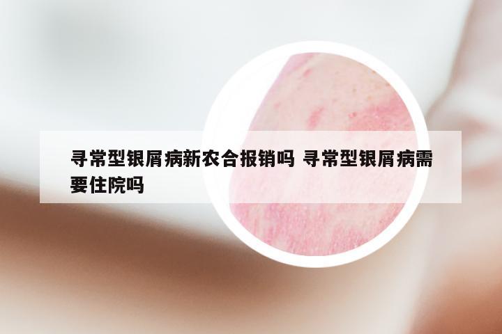 寻常型银屑病新农合报销吗 寻常型银屑病需要住院吗