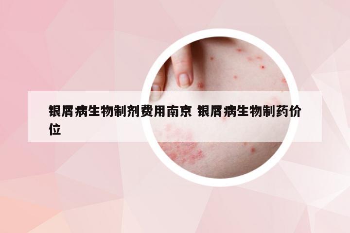 银屑病生物制剂费用南京 银屑病生物制药价位