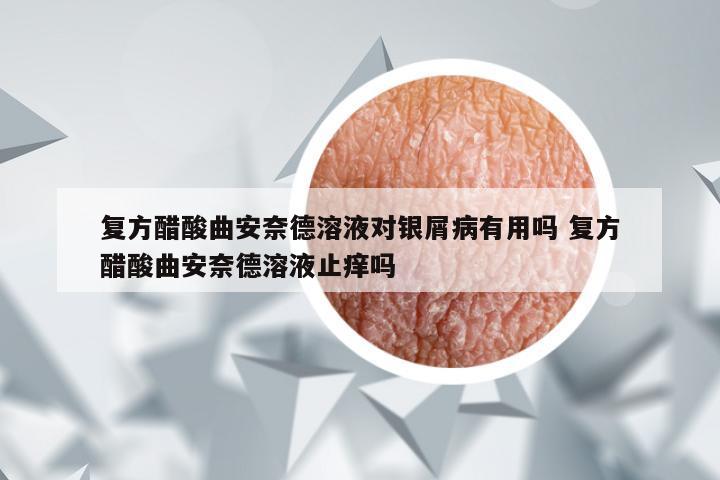 复方醋酸曲安奈德溶液对银屑病有用吗 复方醋酸曲安奈德溶液止痒吗