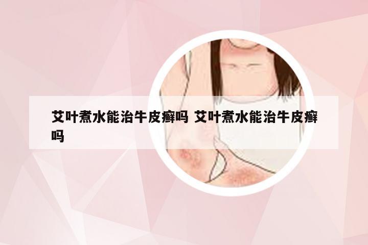 艾叶煮水能治牛皮癣吗 艾叶煮水能治牛皮癣吗