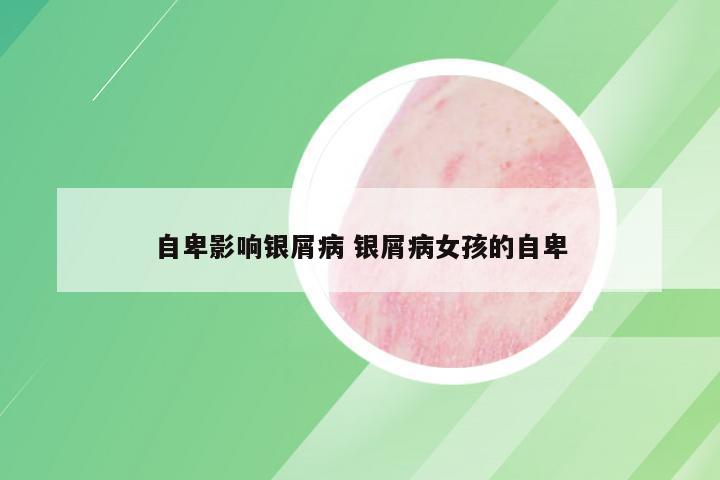 自卑影响银屑病 银屑病女孩的自卑