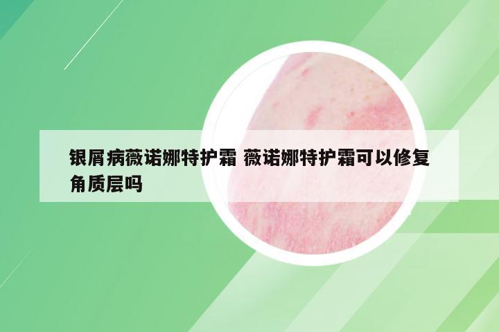 银屑病薇诺娜特护霜 薇诺娜特护霜可以修复角质层吗
