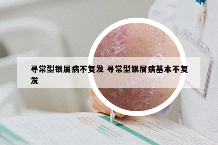 寻常型银屑病不复发 寻常型银屑病基本不复发