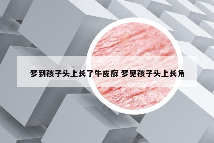梦到孩子头上长了牛皮癣 梦见孩子头上长角