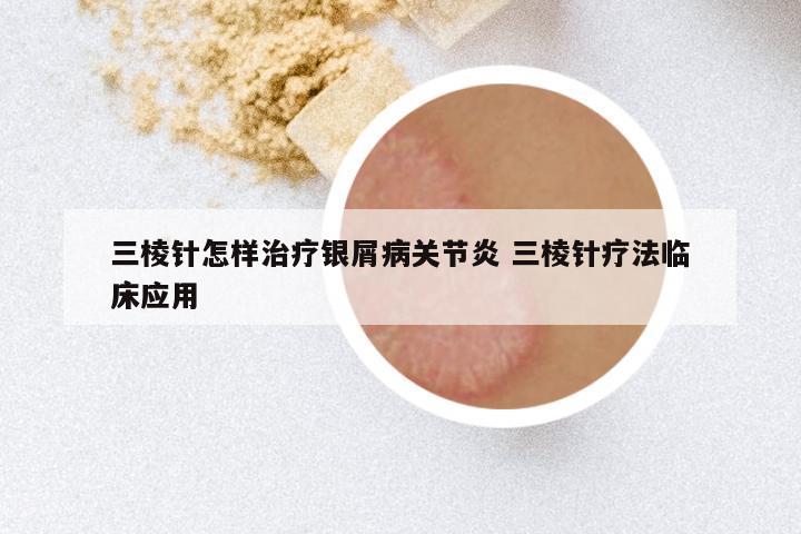 三棱针怎样治疗银屑病关节炎 三棱针疗法临床应用