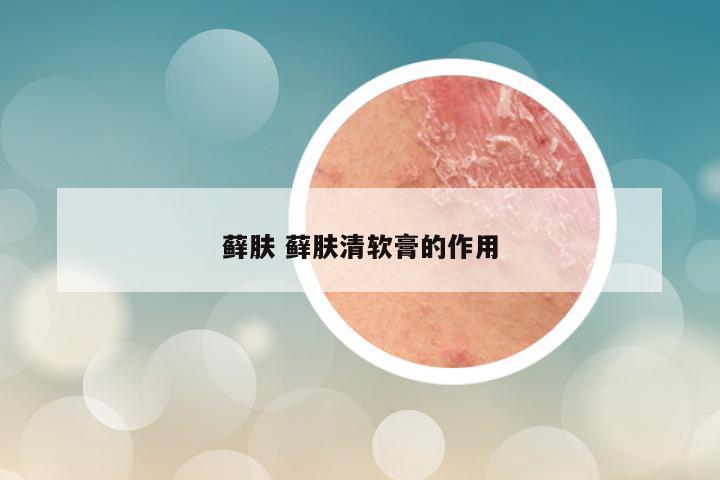 藓肤 藓肤清软膏的作用