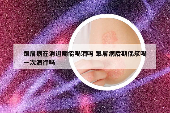 银屑病在消退期能喝酒吗 银屑病后期偶尔喝一次酒行吗