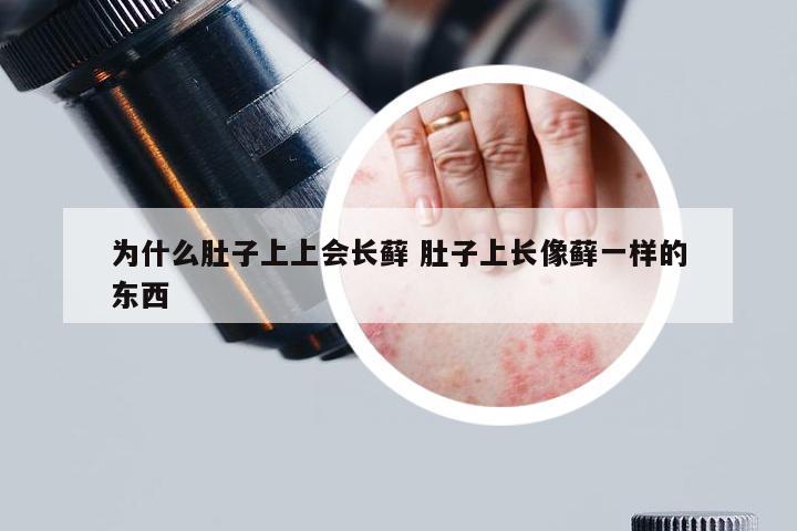 为什么肚子上上会长藓 肚子上长像藓一样的东西