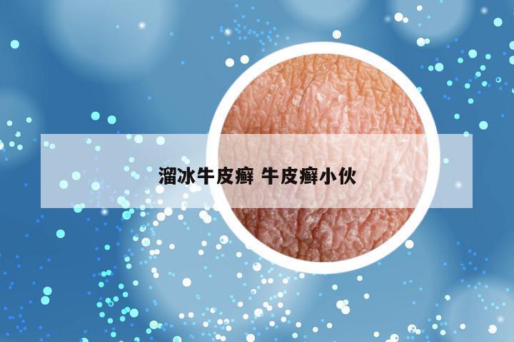 溜冰牛皮癣 牛皮癣小伙