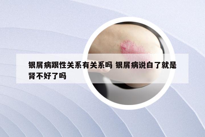 银屑病跟性关系有关系吗 银屑病说白了就是肾不好了吗