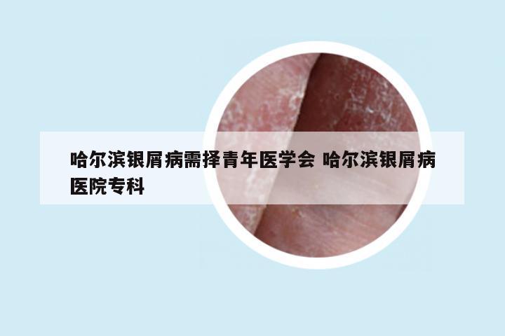 哈尔滨银屑病需择青年医学会 哈尔滨银屑病医院专科