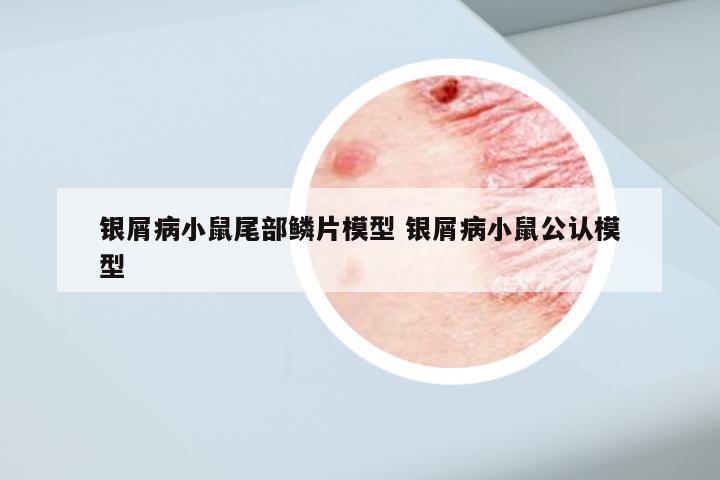 银屑病小鼠尾部鳞片模型 银屑病小鼠公认模型