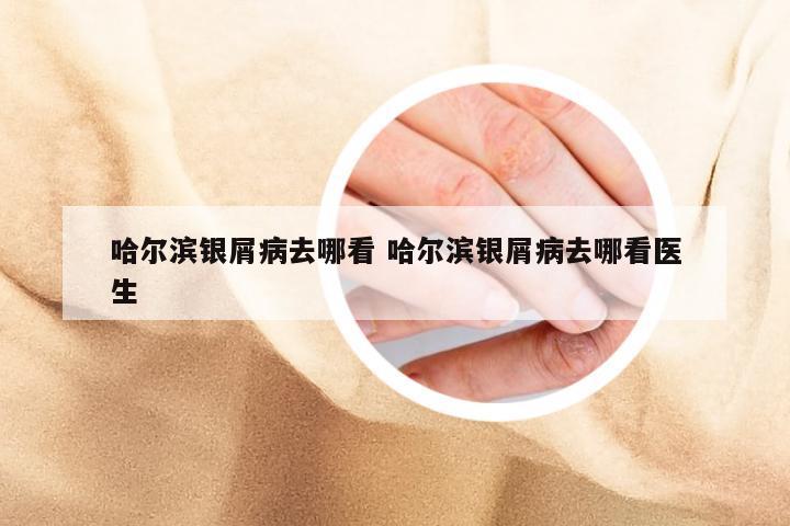 哈尔滨银屑病去哪看 哈尔滨银屑病去哪看医生