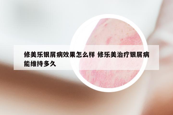 修美乐银屑病效果怎么样 修乐美治疗银屑病能维持多久