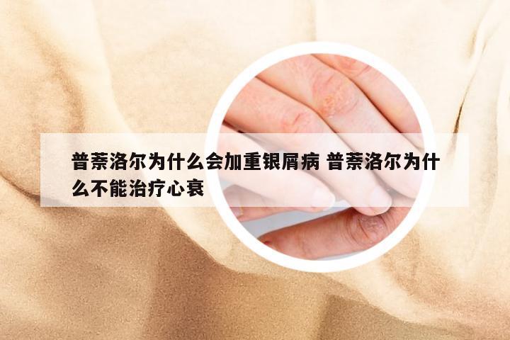 普萘洛尔为什么会加重银屑病 普萘洛尔为什么不能治疗心衰