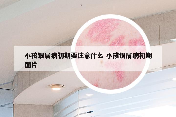 小孩银屑病初期要注意什么 小孩银屑病初期图片