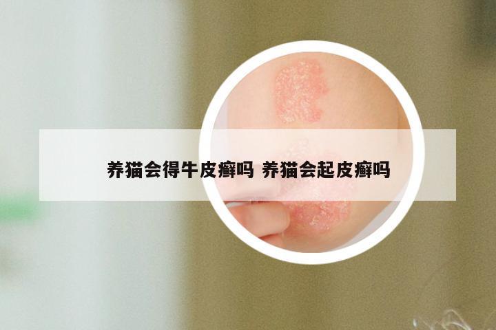 养猫会得牛皮癣吗 养猫会起皮癣吗