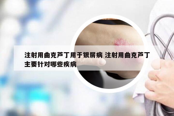 注射用曲克芦丁用于银屑病 注射用曲克芦丁主要针对哪些疾病