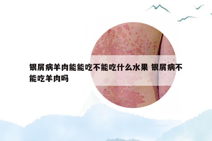 银屑病羊肉能能吃不能吃什么水果 银屑病不能吃羊肉吗