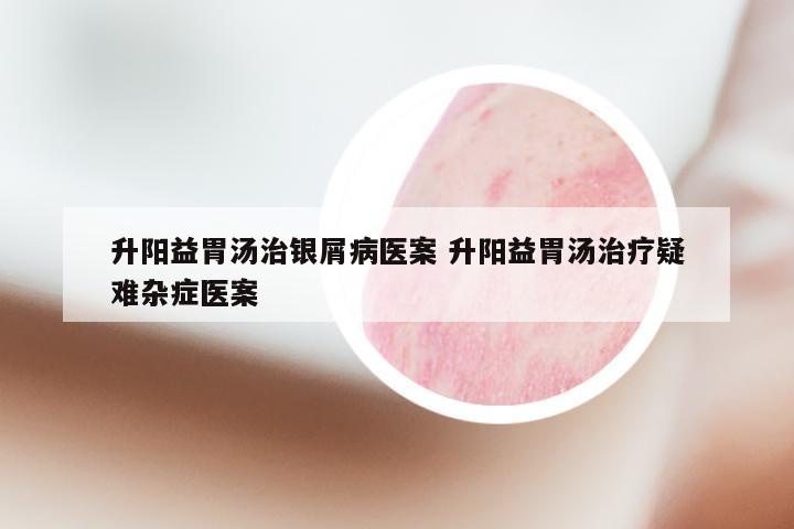 升阳益胃汤治银屑病医案 升阳益胃汤治疗疑难杂症医案