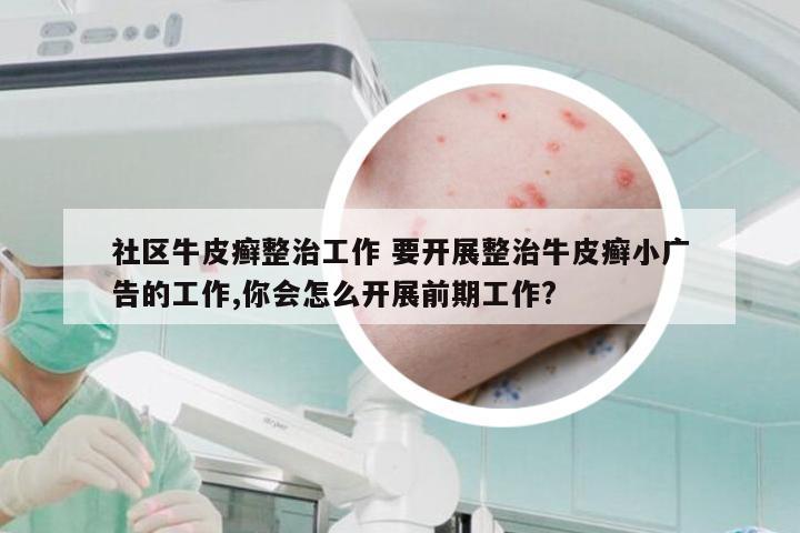 社区牛皮癣整治工作 要开展整治牛皮癣小广告的工作,你会怎么开展前期工作?