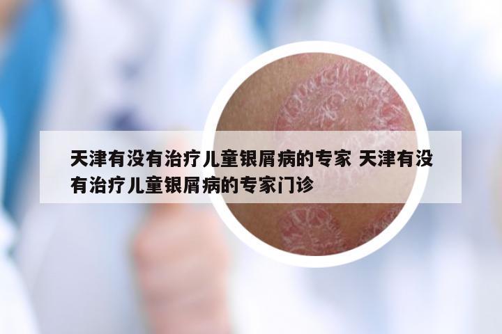 天津有没有治疗儿童银屑病的专家 天津有没有治疗儿童银屑病的专家门诊