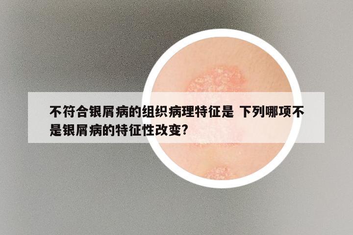 不符合银屑病的组织病理特征是 下列哪项不是银屑病的特征性改变?