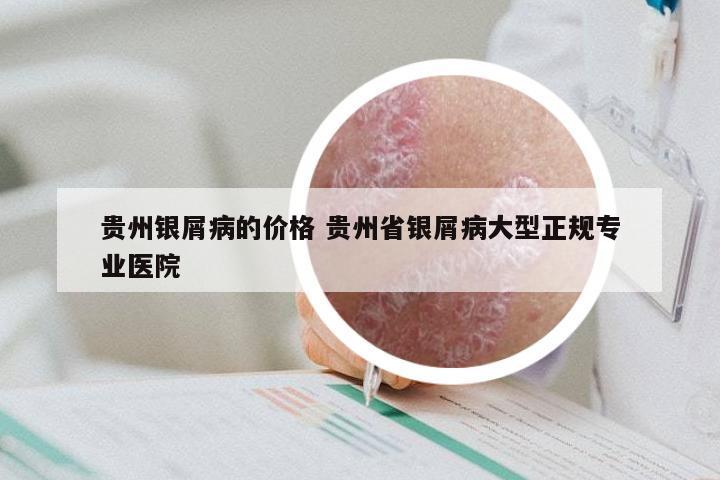 贵州银屑病的价格 贵州省银屑病大型正规专业医院