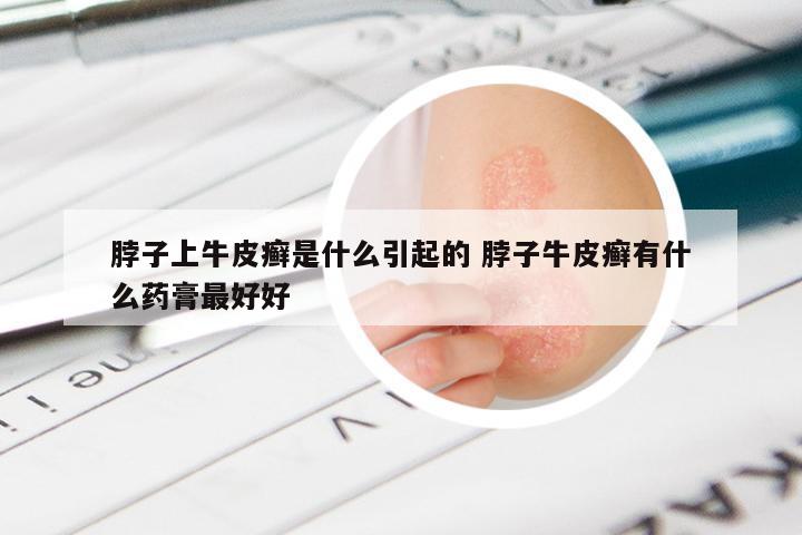 脖子上牛皮癣是什么引起的 脖子牛皮癣有什么药膏最好好