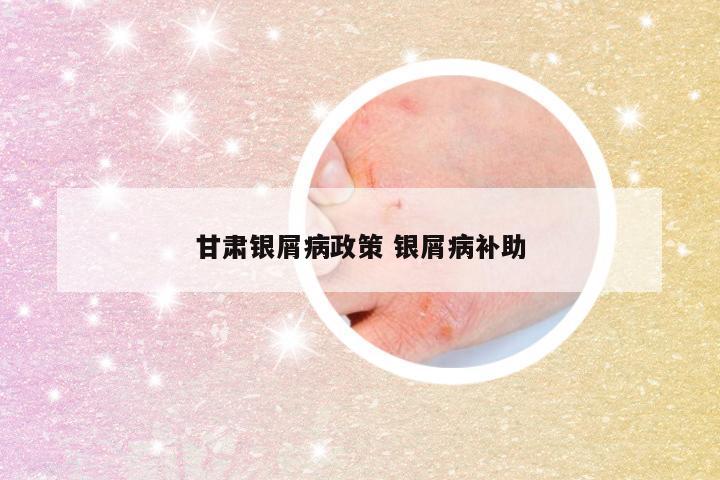 甘肃银屑病政策 银屑病补助
