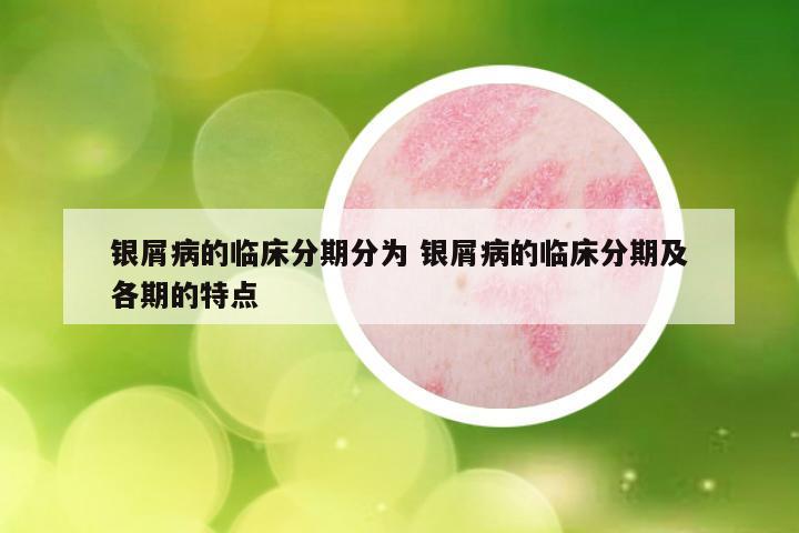 银屑病的临床分期分为 银屑病的临床分期及各期的特点