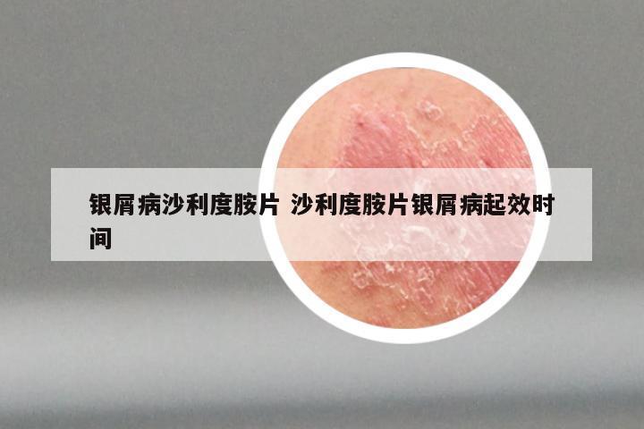 银屑病沙利度胺片 沙利度胺片银屑病起效时间