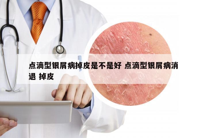 点滴型银屑病掉皮是不是好 点滴型银屑病消退 掉皮