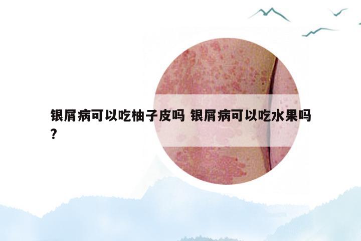银屑病可以吃柚子皮吗 银屑病可以吃水果吗?