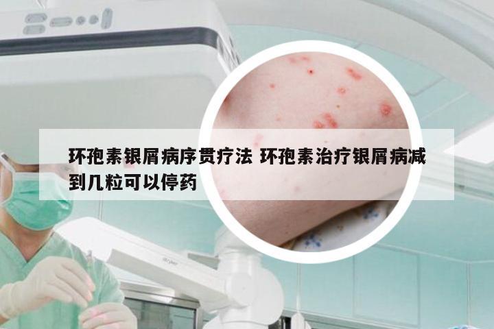 环孢素银屑病序贯疗法 环孢素治疗银屑病减到几粒可以停药