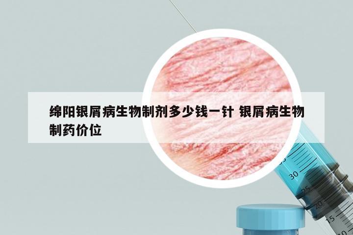 绵阳银屑病生物制剂多少钱一针 银屑病生物制药价位