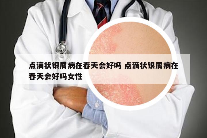 点滴状银屑病在春天会好吗 点滴状银屑病在春天会好吗女性