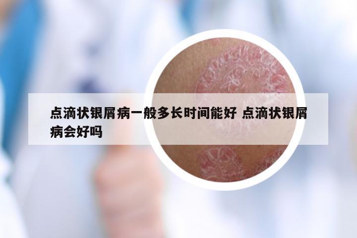 点滴状银屑病一般多长时间能好 点滴状银屑病会好吗