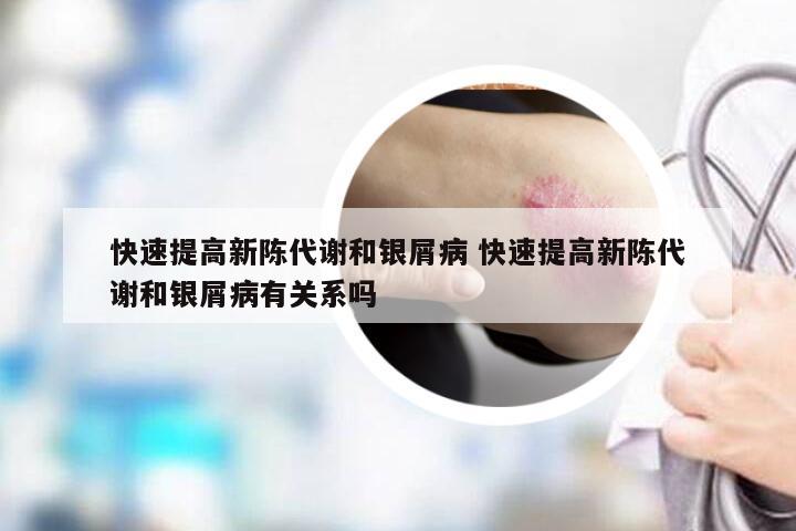 快速提高新陈代谢和银屑病 快速提高新陈代谢和银屑病有关系吗