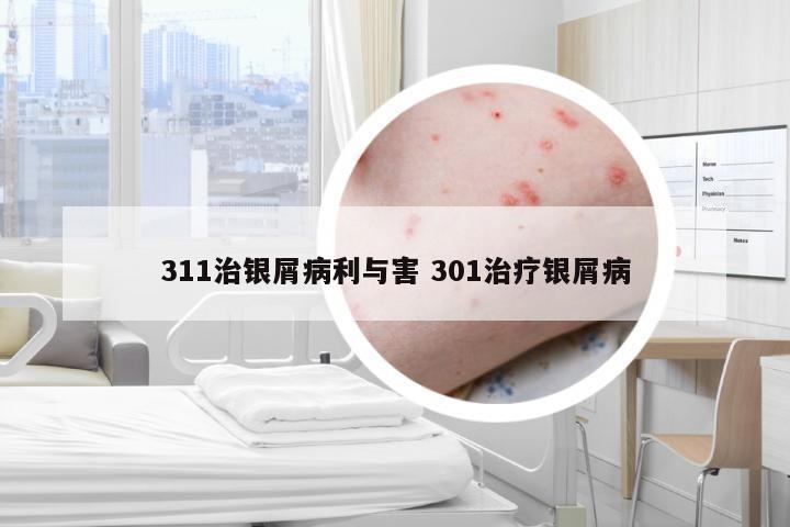 311治银屑病利与害 301治疗银屑病