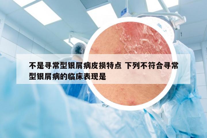不是寻常型银屑病皮损特点 下列不符合寻常型银屑病的临床表现是